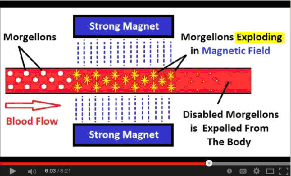 magnets kill morgellons