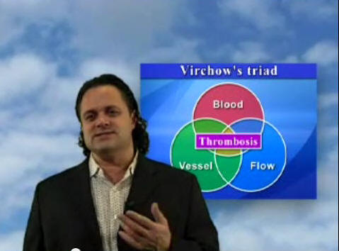 Virchow's Triad