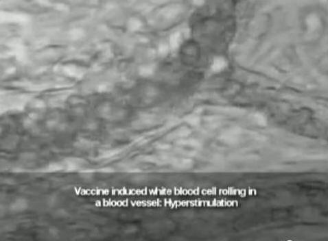 Vaccine induced white blood cell rolling in a blood vessel: Hyperstimulation