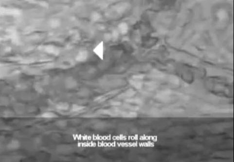 White blood cells roll along inside blood vessel walls